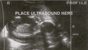 ultrasoundsample